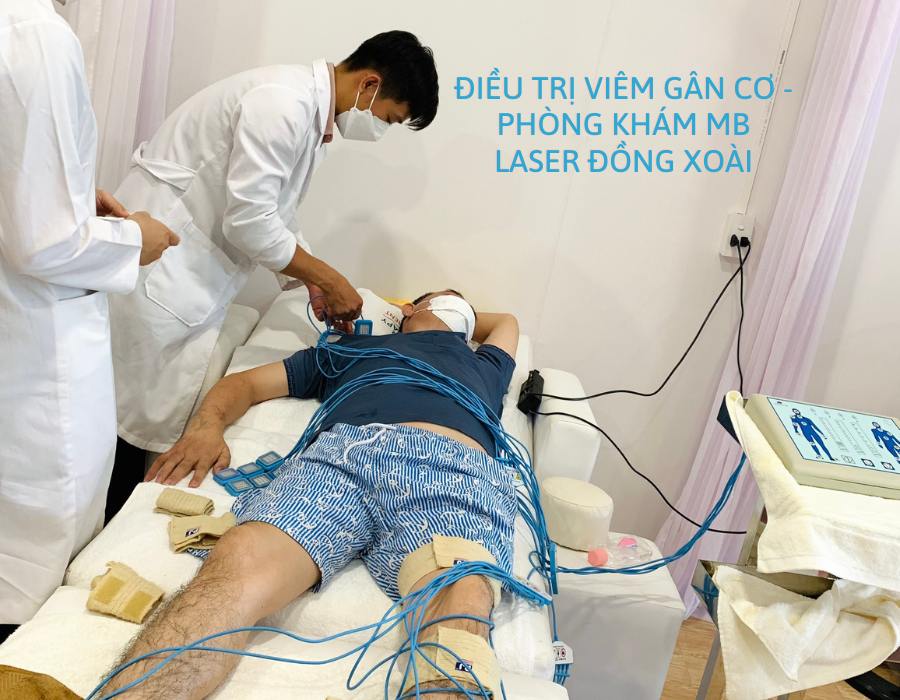Điều Trị Viêm gân cơ - Phòng Khám MB Laser Đồng Xoài