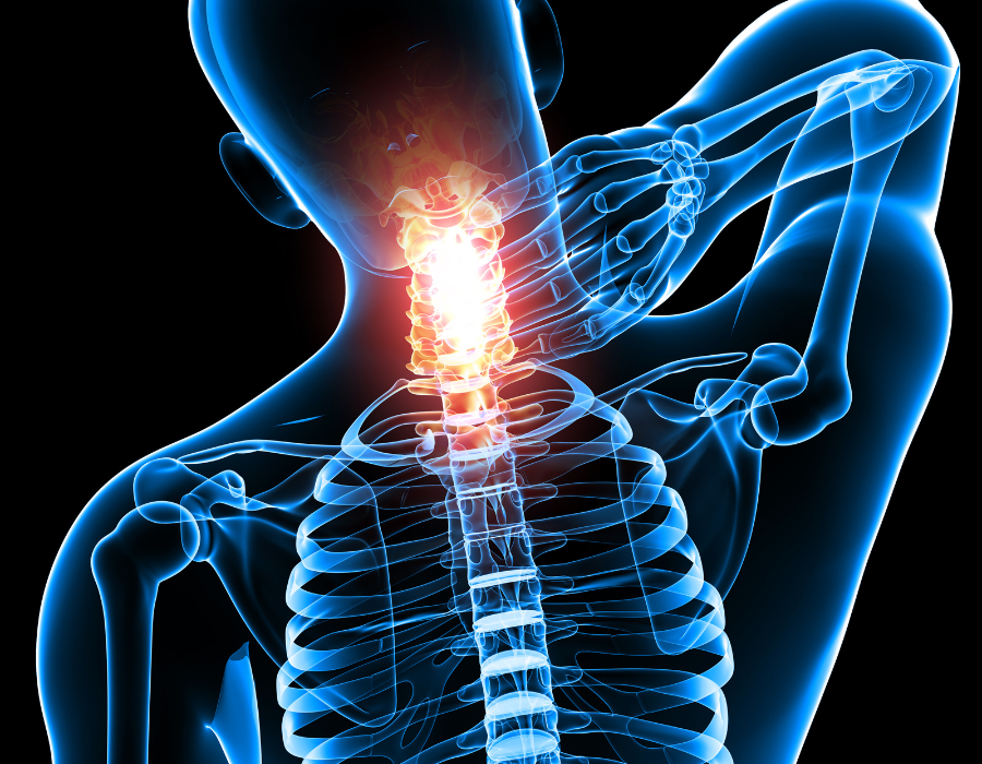 Bệnh Đau Vai Gáy Có Nguy Hiểm Không ? Phòng Khám MB Laser ĐỒNG XOÀI
