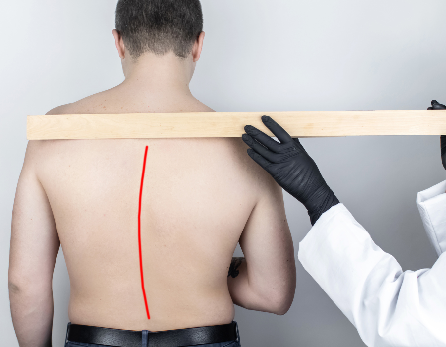 Gai Đôi S1 Có Nguy Hiểm Không? Phòng Khám MB Laser ĐỒNG XOÀI