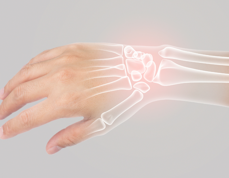 Mổ Hội Chứng Ống Cổ Tay Bao Lâu Là Lành Phòng Khám MB Laser ĐỒNG XOÀI