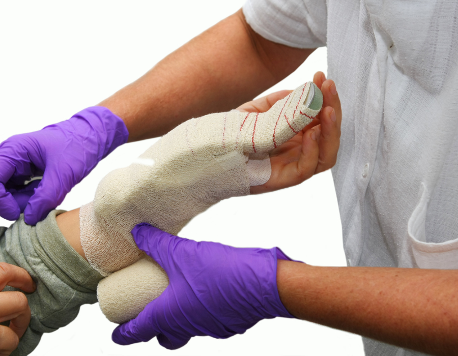 Mổ Hội Chứng Ống Cổ Tay Bao Lâu Là Lành Phòng Khám MB Laser ĐỒNG XOÀI